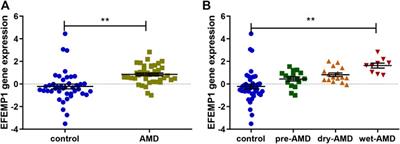 EFEMP1 Overexpression Contributes to Neovascularization in Age-Related Macular Degeneration